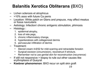 Balanitis Xerotica Obliterans (BXO)
– Lichen sclerosis et atrophicus
– >10% asso with future Ca penis
– Location: White patch on Glans and prepuce, may affect meatus
  or fossa navicularis
– Aetiology: Infection/ chronic antigenic stimulation, phimosis
– Histology :
    1.   epidermal atrophy,
    2.   loss of rete pegs,
    3.   chronic inflammatory change,
    4.   hyperkeratosis with collagenized dermis
    5.   perivascular infiltration of dermis
– Treatment:
    •    Steroid cream 4-6/52 for mild scarring and retractable foreskin
    •    Surgical excision (circumcision), reconstruct if stricture.
    •    Remember not to use genital skin for reconstruction (recurrence)
– If still not responsive > biopsy to rule out other causes like
  erythroplasia of Queyrat
– Koebner phenomenon: BXO recur on split skin graft
                                                         19
 