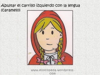 Abultar el carrillo izquierdo con la lengua (caramelo) www.ellocopeda.wordpress.com 