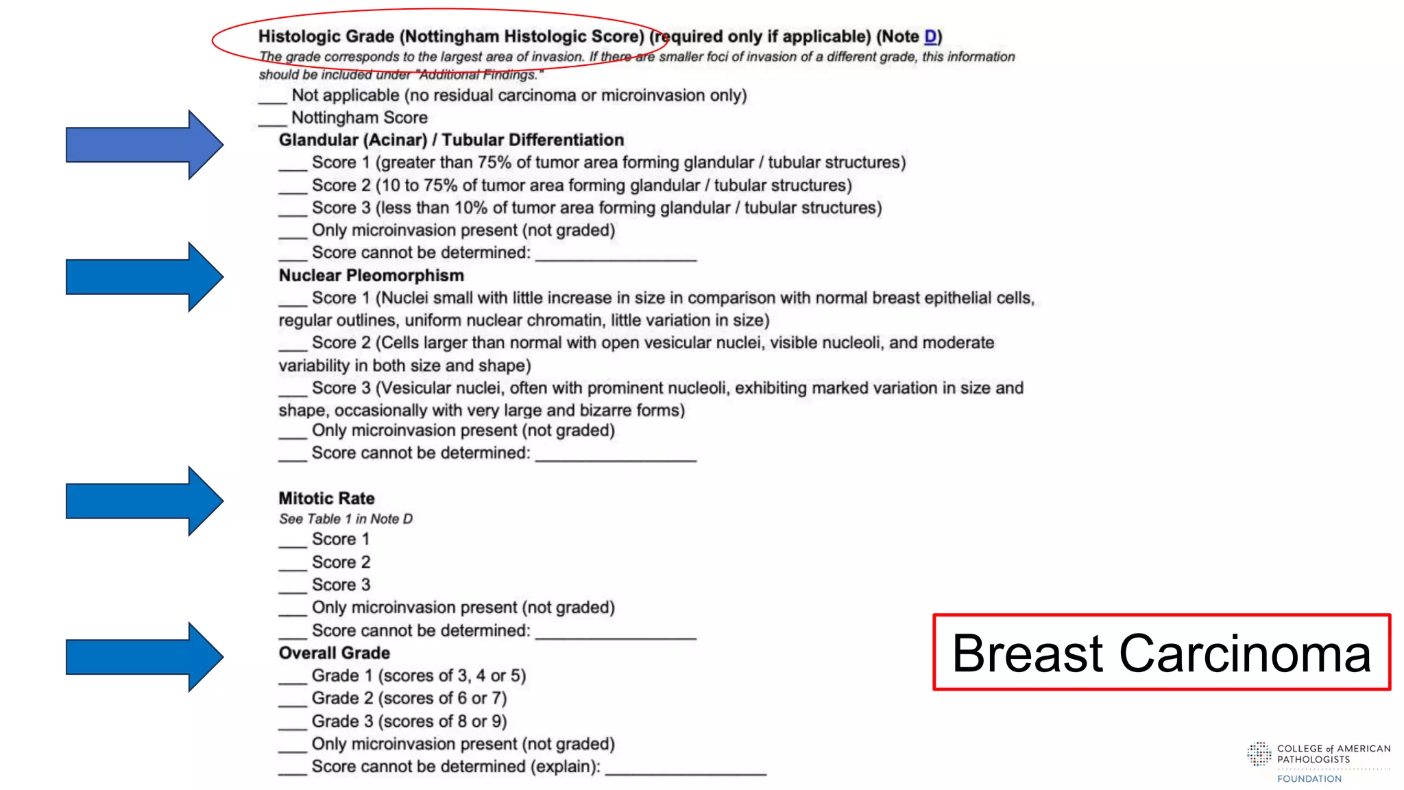 Breast Carcinoma
 