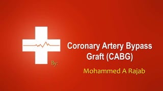 By:
Mohammed A Rajab
Coronary Artery Bypass
Graft (CABG)
 