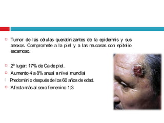  Tumor de las células queratinizantes de la epidermis y sus
anexos. Compromete a la piel y a las mucosas con epitelio
escamoso.
 2º lugar: 17% deCadepiel.
 Aumento 4 a8% anual anivel mundial
 Predominio despuésdelos60 añosdeedad.
 Afectamásal sexo femenino 1:3
 
