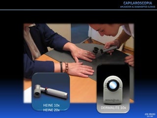 Capilaroscopia 2007