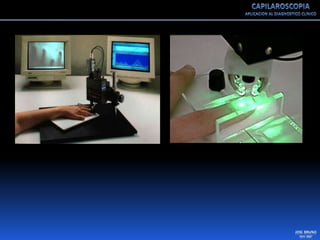 Capilaroscopia 2007