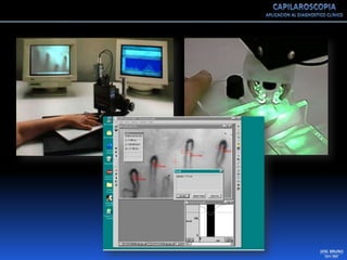 Capilaroscopia 2007