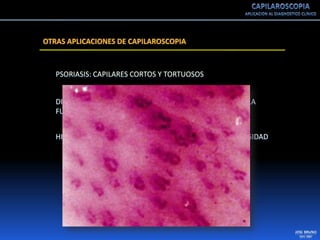Capilaroscopia 2007