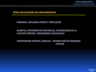 Capilaroscopia 2007
