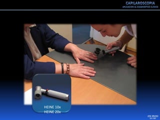 Capilaroscopia 2007