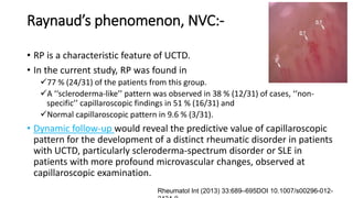Raynaud’s phenomenon, NVC:-
• RP is a characteristic feature of UCTD.
• In the current study, RP was found in
77 % (24/31) of the patients from this group.
A ‘‘scleroderma-like’’ pattern was observed in 38 % (12/31) of cases, ‘‘non-
specific’’ capillaroscopic findings in 51 % (16/31) and
Normal capillaroscopic pattern in 9.6 % (3/31).
• Dynamic follow-up would reveal the predictive value of capillaroscopic
pattern for the development of a distinct rheumatic disorder in patients
with UCTD, particularly scleroderma-spectrum disorder or SLE in
patients with more profound microvascular changes, observed at
capillaroscopic examination.
Rheumatol Int (2013) 33:689–695DOI 10.1007/s00296-012-
 