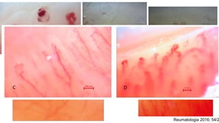 Reumatologia 2016; 54/2
 
