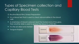 Types of Specimen collection and
Capillary Blood Tests
D. Routine Blood Film/ Smear Preparation
 It is a blood test that is used to check abnormalities in the blood
cells
 A small drop of blood is placed neat the frosted end of the glass,
then another slide is used to spread the blood in a thin film
 It is the air dried and stained
 Tongue-shaped
 