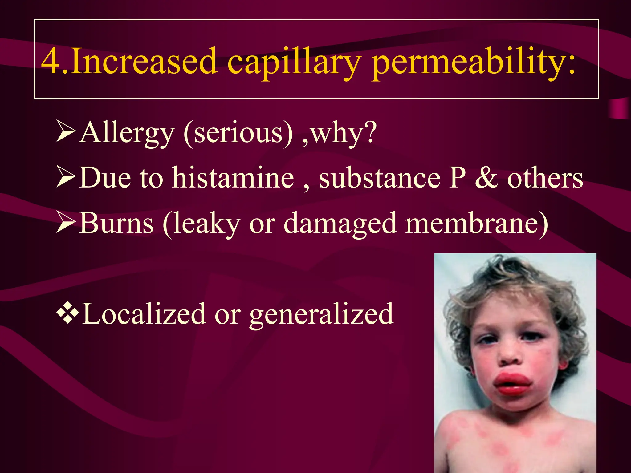Increased Capillary Capillary circulation & fluid exchange.pdf