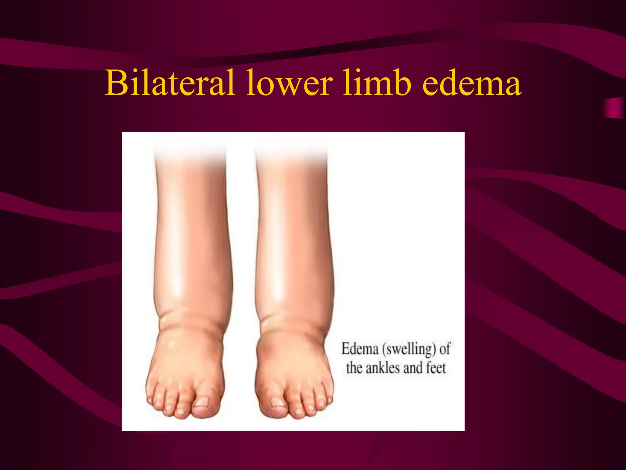Capillary circulation & fluid exchange.pdf