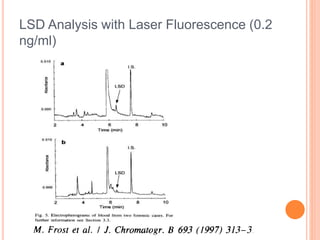 LSD Analysis with Laser Fluorescence (0.2
ng/ml)
 