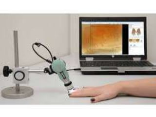 capillaroscopy | PPTX