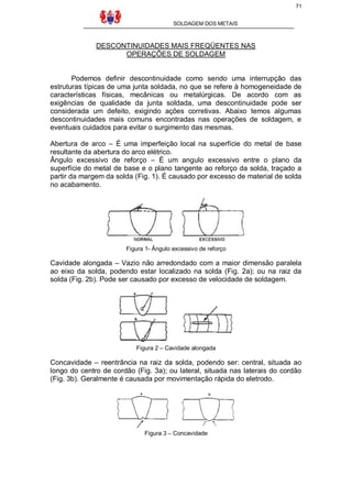 71
SOLDAGEM DOS METAIS

DESCONTINUIDADES MAIS FREQÜENTES NAS
OPERAÇÕES DE SOLDAGEM

Podemos definir descontinuidade como sendo uma interrupção das
estruturas típicas de uma junta soldada, no que se refere à homogeneidade de
características físicas, mecânicas ou metalúrgicas. De acordo com as
exigências de qualidade da junta soldada, uma descontinuidade pode ser
considerada um defeito, exigindo ações corretivas. Abaixo temos algumas
descontinuidades mais comuns encontradas nas operações de soldagem, e
eventuais cuidados para evitar o surgimento das mesmas.
Abertura de arco – É uma imperfeição local na superfície do metal de base
resultante da abertura do arco elétrico.
Ângulo excessivo de reforço – É um angulo excessivo entre o plano da
superfície do metal de base e o plano tangente ao reforço da solda, traçado a
partir da margem da solda (Fig. 1). É causado por excesso de material de solda
no acabamento.

Figura 1- Ângulo excessivo de reforço

Cavidade alongada – Vazio não arredondado com a maior dimensão paralela
ao eixo da solda, podendo estar localizado na solda (Fig. 2a); ou na raiz da
solda (Fig. 2b). Pode ser causado por excesso de velocidade de soldagem.

Figura 2 – Cavidade alongada

Concavidade – reentrância na raiz da solda, podendo ser: central, situada ao
longo do centro de cordão (Fig. 3a); ou lateral, situada nas laterais do cordão
(Fig. 3b). Geralmente é causada por movimentação rápida do eletrodo.

Figura 3 – Concavidade

 