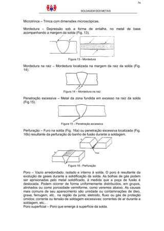 74
SOLDAGEM DOS METAIS

Microtrinca – Trinca com dimensões microscópicas.
Mordedura – Depressão sob a forma de entalhe, no metal de base
acompanhando a margem da solda (Fig. 13).

Figura 13 - Mordedura

Mordedura na raiz – Mordedura localizada na margem da raiz da solda (Fig.
14).

Figura 14 – Mordedura na raiz

Penetração excessiva – Metal da zona fundida em excesso na raiz da solda
(Fig.15).

Figura 15 – Penetração excessiva

Perfuração – Furo na solda (Fig. 16a) ou penetração excessiva localizada (Fig.
16b) resultante da perfuração do banho de fusão durante a soldagem.

Figura 16 - Perfuração

Poro – Vazio arredondado, isolado e interno à solda. O poro é resultante da
evolução de gases durante a solidificação da solda. As bolhas de gás podem
ser aprisionadas pelo metal solidificado, à medida que a poça de fusão é
deslocada. Podem ocorrer de forma uniformemente distribuídos, em grupos,
alinhados ou como porosidade vermiforme, como veremos abaixo. As causas
mais comuns de seu aparecimento são umidade ou contaminações de óleo,
graxa, ferrugem, etc.. na região da junta; eletrodo, fluxo ou gás de proteção
úmidos; corrente ou tensão de soldagem excessivas; correntes de ar durante a
soldagem, etc.. .
Poro superficial – Poro que emerge à superfície da solda.

 