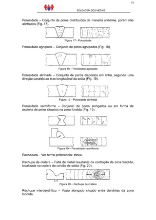 75
SOLDAGEM DOS METAIS

Porosidade – Conjunto de poros distribuídos de maneira uniforme, porém não
alinhados (Fig. 17).

Figura 17 - Porosidade

Porosidade agrupada – Conjunto de poros agrupados (Fig. 18).

Figura 18 – Porosidade agrupada

Porosidade alinhada – Conjunto de poros dispostos em linha, segundo uma
direção paralela ao eixo longitudinal da solda (Fig. 19).

Figura 19 – Porosidade alinhada

Porosidade vermiforme – Conjunto de poros alongados ou em forma de
espinha de peixe situados na zona fundida (Fig. 19).

Figura 19 – Porosidade vermiforme

Rachadura – Ver termo preferencial: trinca.
Rechupe de cratera – Falta de metal resultante da contração da zona fundida,
localizada na cratera do cordão de solda (Fig. 20).

Figura 20 – Rechupe de cratera

Rechupe interdendrítico – Vazio alongado situado entre dendritas da zona
fundida.

 