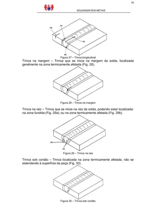 78
SOLDAGEM DOS METAIS

Figura 27 – Trinca longitudinal

Trinca na margem – Trinca que se inicia na margem da solda, localizada
geralmente na zona termicamente afetada (Fig. 28).

Figura 28 – Trinca na margem

Trinca na raiz – Trinca que se inicia na raiz da solda, podendo estar localizada:
na zona fundida (Fig. 29a); ou na zona termicamente afetada (Fig. 29b).

Figura 29 – Trinca na raiz

Trinca sob cordão – Trinca localizada na zona termicamente afetada, não se
estendendo à superfície da peça (Fig. 30).

Figura 30 – Trinca sob cordão

 