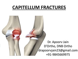 CAPITELLUM FRACTURES
Dr. Apoorv Jain
D’Ortho, DNB Ortho
drapoorvjain23@gmail.com
+91-9845669975
 
