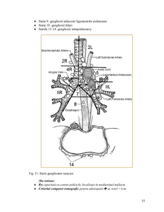  Statia 9: ganglionii adiacenti ligamentelor pulmonare
    Statia 10: ganglionii hilari
    Statiile 11-14: ganglionii intrapulmonary




Fig. 11: Statii ganglionare toracice

     !De retinut:
    Rx: opacitati cu contur policiclic localizate in mediastinul mijlociu
    Criteriul computer tomografic pentru adenopatie ax scurt >1cm


                                                                             15
 