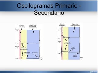 Oscilogramas Primario -
Secundario
 