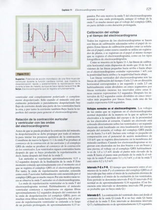 Capitulo 11  electrocardiograma normal