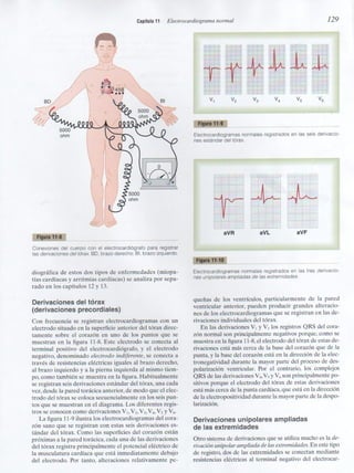 Capitulo 11  electrocardiograma normal
