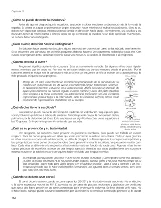 Capítulo 12


¿Cómo se puede detectar la escoliosis?
      Antes de que se diagnostique la escoliosis, se puede explorar mediante la observación de la forma de la
espalda. Si la niña es capaz de permanecer de pie, se puede hacer mientras se inclina hacia adelante. Si no lo es,
deberá ser explorada sentada, mirándola desde arriba en dirección hacia abajo. Normalmente, las costillas y los
músculos tienen la misma forma a ambos lados del eje central de la espalda. Si un lado sobresale mucho más,
se debería hacer una radiografía.

¿Cada cuánto deberían hacerse radiografías?
       Se deberían hacer cuando se descubre alguna anomalía en una revisión como se ha indicado anteriormente.
Si se encuentra una curvatura, en las niñas pequeñas debería hacerse un seguimiento radiológico cada año. Con
curvas de progresión lenta, deberían repetirse cada seis meses si se acelera el crecimiento o la progresión.

¿Cuánto crecerá la curva?
      Progresión significa aumento de curvatura. Esto es sumamente variable. En algunas niñas crece rápida-
mente, mientras que en otras no. Por eso no se tratan todas las curvas menores desde el principio. Por el
contrario, mientras mayor sea la curvatura y más próxima se encuentre la niña al estirón de la adolescencia, lo
más probable es que la curva progrese.                                                           MÉDULA ESPINAL



         Mi hija de 31 años experimentó un crecimiento pronunciado de la curvatura de su
         columna en el decenio de los 20. No se le recomendó ningún tratamiento, solamen -
         te observarla mientras estuviese en la adolescencia. Ahora necesita un montón de
         ayuda para mantener su cabeza erguida cuando camina y fuera del plato mientras                  IMAGEN POSTERIOR

         está sentada a la mesa comiendo. Su adolescencia transcurrió sin una escoliosis                           MÉDULA
                                                                                                                   ESPINAL
         espectacular, pero al llegar a la edad adulta, tanto la escoliosis como la cifosis están
         produciendo repercusiones dramáticas en su cuerpo.

¿Qué efectos tiene la escoliosis?                                                                         IMAGEN LATERAL


       La escoliosis puede causar la alteración del equilibrio en sedestación, lo que puede pro-
vocar problemas prácticos a la hora de sentarse. También puede causar la compresión de los
pulmones por la distorsión del tórax. Esto empieza a ser significativo con curvas superiores a                       MÉDULA
los 70 grados. Es importante prevenirlo antes de que suceda.                                         IMAGEN SUPERIOR ESPINAL

                                                                                                     Vértebra: vista desde
                                                                                                    detrás, desde el lado y
¿Cuál es su prevención y su tratamiento?                                                                 desde arriba.
       Por desgracia, no sabemos cómo prevenir en general la escoliosis, pero puede ser tratada en cuanto
empiece. Para las curvas pequeñas en niñas que están creciendo se utilizan correctores. En las curvas grandes
en niñas mayores cercanas a la adolescencia, se utiliza la cirugía. Los fisioterapeutas, los cirujanos ortopédicos y
los quiroprácticos no se ponen de acuerdo sobre cómo prevenir y tratar la escoliosis, lo que puede resultar con-
fuso. Cada niña es diferente y la respuesta al tratamiento varía en función de cada caso. Algunas niñas tienen
signos precoces de escoliosis a pesar de una terapia agresiva, mientras que otras pueden tener una curvatura
mínima incluso en la adolescencia y sin siquiera haber recibido una terapia intensiva.

         El ortopeda quería ponerle un corsé. Y a mí se me hundió el mundo. ¿Cómo podría sentir mis abrazos?
         ¿Cómo la llevaría en brazos? Ella no puede andar todavía, aunque gatea y no pasa mucho tiempo en su
         silla de ruedas -sobre todo para viajes largos y en el autobús escolar-. Volví a casa y contraté a un fisio -
         terapeuta privado que le hace estiramientos semanales. No aguanta bien la semana entera, pero creo
         que cada vez está más fuerte.

¿Cuándo se debería usar corsé?
       El corsé debería usarse cuando la curva supera los 20-25º y la niña todavía está creciendo. No es efectivo
si la curva sobrepasa mucho los 45º. El corrector es un corsé de plástico, moldeado y guateado con un diseño
que aplica una ligera presión en las zonas apropiadas para enderezar la columna. Se lleva debajo de la ropa. No
le hace daño, aunque puede causarle rozamientos por la presión si se empieza demasiado pronto o se le queda

162
 
