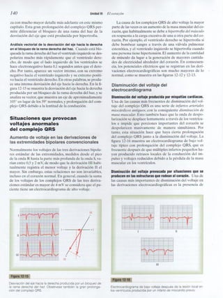 Capitulo 12  interpretacón electrocardiografica