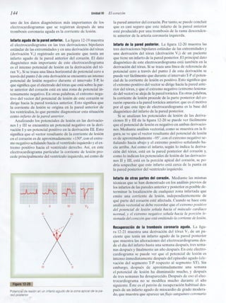 Capitulo 12  interpretacón electrocardiografica