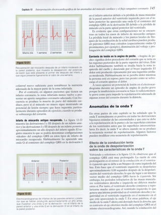 Capitulo 12  interpretacón electrocardiografica