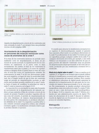 Capitulo 12  interpretacón electrocardiografica