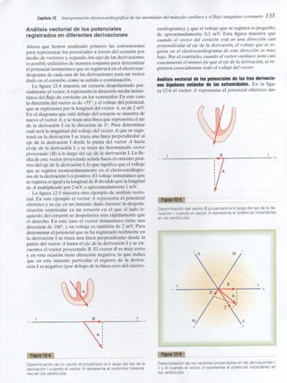 Capitulo 12  interpretacón electrocardiografica