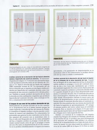 Capitulo 12  interpretacón electrocardiografica