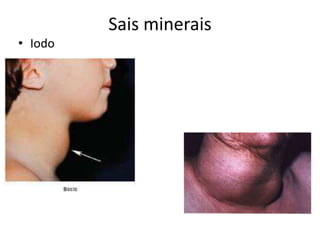 Sais minerais
• Iodo
 