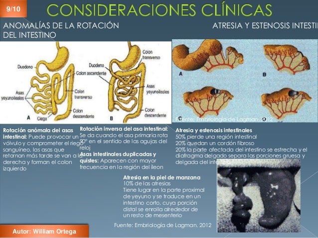 Embriología del Aparato digestivoIntestino Medio.