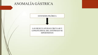 ANOMALÍA GÁSTRICA
LAS MUSCULATURAS CIRCULAR Y
LONGITUDINAL DEL ESTÓMAGO SE
HIPERTROFAN
ESTENOSIS PILÓRICA
 