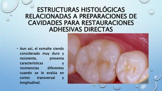 ESTRUCTURAS HISTOLÓGICAS 
RELACIONADAS A PREPARACIONES DE 
CAVIDADES PARA RESTAURACIONES 
ADHESIVAS DIRECTAS 
• Aun así, el esmalte siendo 
considerado muy duro y 
resistente, presenta 
características y 
resistencias diferentes 
cuando se le evalúa en 
cortes transversal y 
longitudinal. 
 