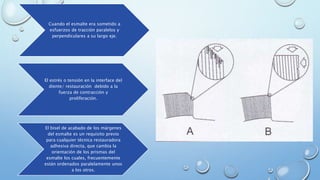 Cuando el esmalte era sometido a 
esfuerzos de tracción paralelos y 
perpendiculares a su largo eje. 
El estrés o tensión en la interface del 
diente/ restauración debido a la 
fuerza de contracción y 
proliferación. 
El bisel de acabado de los márgenes 
del esmalte es un requisito previo 
para cualquier técnica restauradora 
adhesiva directa, que cambia la 
orientación de los prismas del 
esmalte los cuales, frecuentemente 
están ordenados paralelamente unos 
a los otros. 
 
