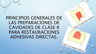 PRINCIPIOS GENERALES DE 
LAS PREPARACIONES DE 
CAVIDADES DE CLASE II 
PARA RESTAURACIONES 
ADHESIVAS DIRECTAS. 
 