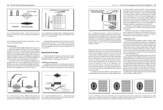 durante la lectura del eco, de tal manera que los protones de
las distintas columnas precesan con una frecuencia diferente
según el campo magnético percibido. En una secuencia SE
convencional se codifican todas las columnas tras un único
pulso de excitación de radiofrecuencia de 900. El gradiente
para la codificación de frecuencia se aplica durante la obten-
ción del eco mediante un gradiente de desfase al comienzo,
que se invierte a lo largo del eco, de tal manera que en el cen-
tro del eco el desfase es 0 (Fig. 13). En cada punto o mo-
mento de muestreo del eco, los protones de la muestra tie-
nen una frecuencia diferente en sentido horizontal. Durante
el eco, los protones del corte tienen diferentes frecuencias en
sentido horizontal.
La señal de eco tiene una amplitud creciente primero y de-
creciente después por dos motivos: a) el refase mediante el pul-
so de RF de 1800 y el posterior desfase, y b) por la aplicación
del gradiente durante la lectura del eco. El gradiente produce
un desfase máximo al inicio del eco, pasa por un desfase igual
a 0 en el punto medio y alcanza un desfase máximo en sentido
inverso al final (Fig. 14). El eco es una señal analógica que de-
be ser muestreada para su conversión analógico-digital. El
muestreo se efectúa con una determinada frecuencia, deno-
minada frecuencia de muestreo. Posteriormente, se descom-
pone en sus múltiples frecuencias y sus correspondientes in-
tensidades mediante la transformación de Fourier (FT).
Por lo tanto, a cada columna le corresponde una frecuen-
cia, de tal manera que en RM frecuencia equivale a localiza-
ción espacial.
Durante la lectura del eco se adquiere información de to-
das las columnas de la matriz; en la secuencia SE convencio-
nal se obtiene tras un único pulso de excitación. En todos los
TR sucesivos se repite el proceso sin variaciones.
Codificación de fase
La otra dimensión de la imagen, las filas, se obtiene codifi-
cando en fase secuencialmente el espacio K. La información
necesaria para independizar las filas se adquiere codificando en
fase los protones de la muestra. Es necesario adquirir tantas
codificaciones de fase como filas tenga la matriz. Cada codifi-
cación de fase se denomina también vista o perfil. La diferen-
cia entre cada una consiste en la distinta fase de los protones
del corte tomográfico en sentido vertical, que determina una
frecuencia espacial diferente.
Cada vista contiene información de todo el corte, pero con
una fase diferente. En la codificación de fase 0, en la que no se
ha aplicado gradiente en sentido vertical, todos los protones
del corte tienen la misma fase y frecuencia (Fig. 15a). En la pri-
mera codificación de fase los protones se desfasan 3600 desde
el extremo inferior hasta el superior de la imagen. Expresán-
dolo gráficamente podríamos decir que se ha dado una vuelta
de 3600 a la fase de los protones (Fig. 15b). En la segunda co-
dificación de fase, el desfase es de 7200 (Fig. 15c). En cada co-
dificación de fase sucesiva los protones se desfasan otros 3600.
La codificación 127 supone que los protones se han desfasado
128 veces 3600 en sentido vertical.
CAPÍTULO 1 / Técnica de la Imagen por Resonancia Magnética • 15
mero de disparos equivale al número de segmentos, y el nú-
mero de ecos al factor turbo.
Secuencia GraSE
La secuencia GraSE (gradient and spin-echo) es la secuen-
cia rápida más compleja y moderna. En ella, se combinan las
secuencias TSE y EPI. Tras un pulso de excitación se obtienen
múltiples ecos de espín por refase, mediante pulsos de 1800. El
número de ecos de espín equivale al factor turbo. Cada eco de
espín se descompone, a su vez, en múltiples ecos de gradiente
mediante cambios de polaridad muy rápidos del gradiente de
lectura. El número de ecos de gradiente es el factor EPI.
Al igual que en TSE y EPI, se adquieren múltiples vistas o
perfiles en cada TR con una codificación de fase distinta. El
principio, por lo tanto, es un relleno de múltiples líneas del es-
pacio K por cada TR.10 El factor de aceleración es el producto
del factor turbo multiplicado por el factor EPI (Fig. 11).
Es posible adquirir imágenes de alta resolución con tiem-
pos relativamente cortos. 10, 11 El contraste en la secuencia
GRASE está condicionado por los ecos de espín más que por
los ecos de gradiente, por lo que la curva de decaimiento es T2
en vez de T2 *.
Reconstrucción de la imagen
Para la formación de la imagen como una matriz de pixe-
les, la señal obtenida se codifica en fase y frecuencia, para in-
dependizar las filas y columnas (ejes x,y) (Fig. 12).
Codificación de frecuencia
La codificación de frecuencia permite separar una de las
coordenadas de la matriz como, por ejemplo, las columnas.
Esta se efectúa aplicando un gradiente de campo magnético
14 • RM del Sistema Musculoesquelético
Fig. 10. Esquema básico de SE-EPI. SE-EPI: en este caso es el eco
de espín, en vez de la FID, el que se descompone en múltiples ecos
de gradiente.
Fig. 12. Obtención de la imagen en RM. Separación de las filas y
columnas de la matriz mediante la aplicación de gradientes en los
ejes “x” e “y” respectivamente.
Fig. 14. Codificación de frecuencia. Antes de la señal de eco se
aplica un gradiente que desfasa los protones en sentido horizon-
tal. Durante la lectura y muestreo del eco, los protones se refasan
progresivamente. Este gradiente varía las frecuencias en sentido
transversal. En el centro del eco, el gradiente tiene un valor igual a
0 y la frecuencia es 0. En este instante la fase y frecuencia de los
protones es igual en todo el corte. En los extremos del gradiente
el desfase es máximo
Fig. 15. a) Codificación de fase 0: los protones de este corte esquemático del cráneo tienen la misma fase en sentido vertical. b) Codifi-
cación de fase 1: mediante la aplicación de un gradiente los protones se desfasan 3600 en sentido vertical. c) Codificación de fase 2: un
gradiente más intenso que en la figura 15 b, los protones se desfasan 7200 en sentido vertical.
Fig. 11. Esquema de la secuencia GraSE. Combinación de ecos
de espín y ecos de gradiente. Cada eco de espín (componente TSE)
se descompone en múltiples ecos de gradiente (componente EPI).
Fig. 13. Esquema del gradiente de lectura. Durante la lectura del
eco se aplica un gradiente negativo-positivo, que produce dife-
rentes frecuencias en sentido horizontal.
BUSCAR
 