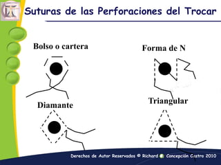Bajo este concepto se debe envolver la cabeza y las manos con fundas de celofán para prevenir las manchas no deseadas por la crema de masaje sobre la vestimenta y del interior del féretro.Embarque de Casos Capítulo XXIIIEs necesario aumentar el volumen del solvente y el índice del soluto, como regla general de 1.0% @ 1.5% a través de un embalsamamiento completo.