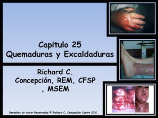 Capitulo 25Quemaduras y Excaldaduras Richard C. Concepción, REM, CFSP, MSEM 