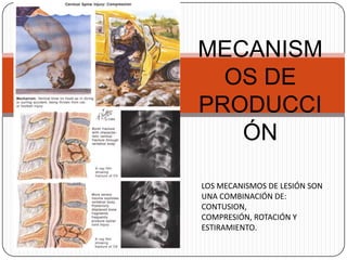 MECANISM
  OS DE
PRODUCCI
   ÓN

LOS MECANISMOS DE LESIÓN SON
UNA COMBINACIÓN DE:
CONTUSION,
COMPRESIÓN, ROTACIÓN Y
ESTIRAMIENTO.
 