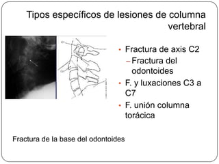 Tipos específicos de lesiones de columna
                                     vertebral

                                • Fractura de axis C2
                                     – Fractura del
                                    odontoides
                                • F. y luxaciones C3 a
                                  C7
                                • F. unión columna
                                  torácica

Fractura de la base del odontoides
 