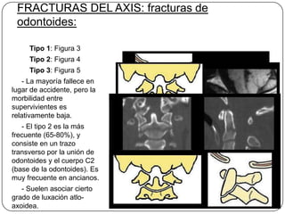 FRACTURAS DEL AXIS: fracturas de
 odontoides:

     Tipo 1: Figura 3
     Tipo 2: Figura 4
     Tipo 3: Figura 5
   - La mayoría fallece en
lugar de accidente, pero la
morbilidad entre
supervivientes es
relativamente baja.
   - El tipo 2 es la más
frecuente (65-80%), y
consiste en un trazo
transverso por la unión de
odontoides y el cuerpo C2
(base de la odontoides). Es
muy frecuente en ancianos.
   - Suelen asociar cierto
grado de luxación atlo-
axoidea.
 