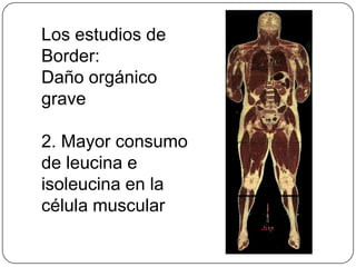 Los estudios de
Border:
Daño orgánico
grave

2. Mayor consumo
de leucina e
isoleucina en la
célula muscular
 