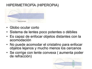 HIPERMETROPÍA (HIPEROPIA)  Globo ocular corto Sistema de lentes poco potentes o débiles  Es capaz de enfocar objetos distantes con la acomodación No puede acomodar el cristalino para enfocar objetos lejanos y mucho menos los cercanos  Se corrige con lente convexa ( aumenta poder de refracción) 