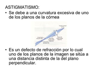 ASTIGMATISMO:  Se debe a una curvatura excesiva de uno de los planos de la córnea Es un defecto de refracción por lo cual uno de los planos de la imagen se sitúa a una distancia distinta de la del plano perpendicular. 