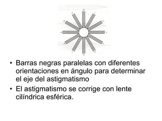 Barras negras paralelas con diferentes orientaciones en ángulo para determinar el eje del astigmatismo El astigmatismo se corrige con lente cilíndrica esférica. 